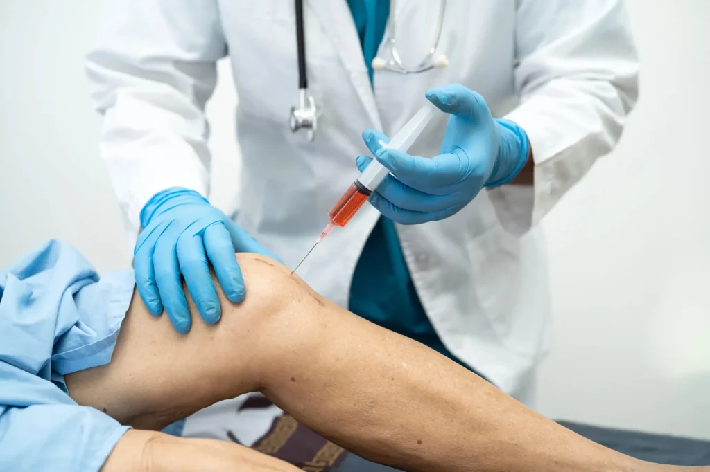 Hyaluronic Acid Injection